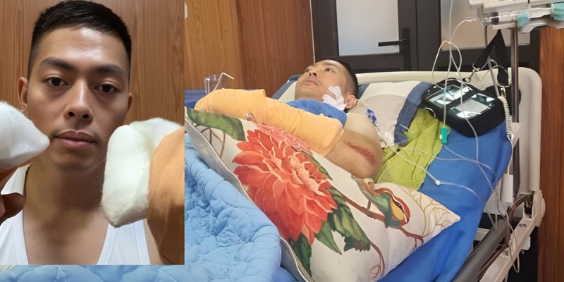 Sau ca phẫu thuật 6 tiếng, Hà Lít đã được nối lại tay